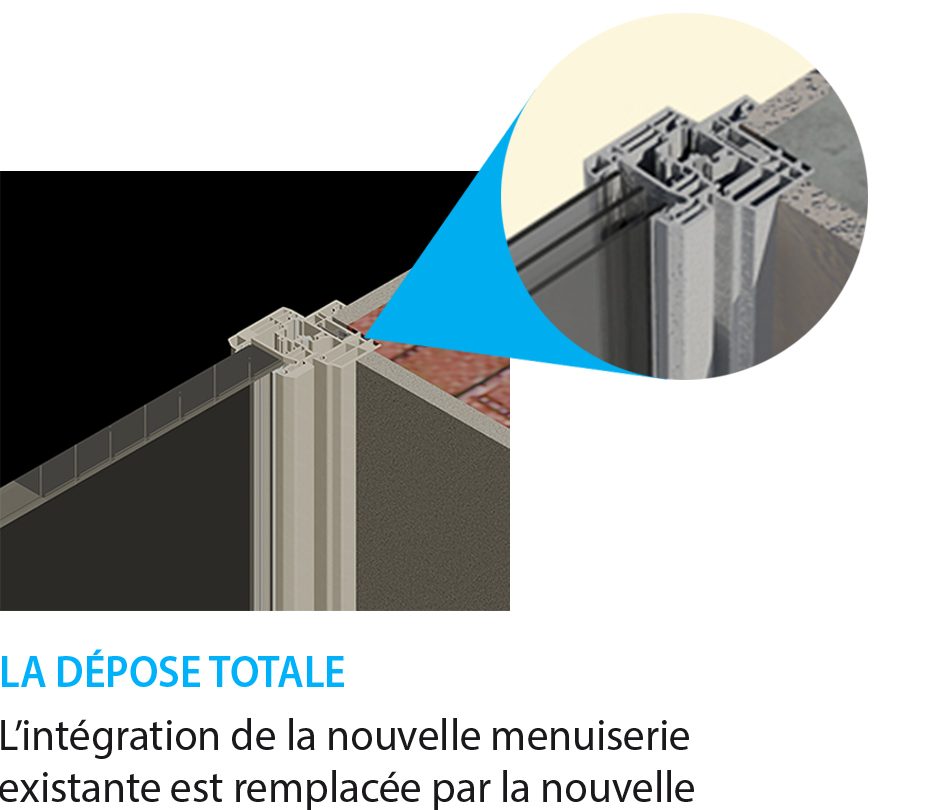 Détail dépose total